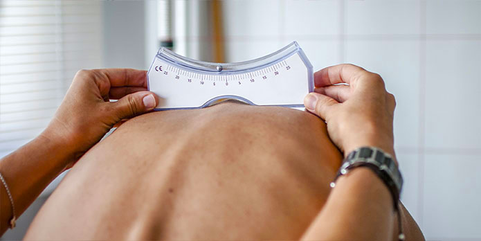 scoliosis and chiropractic conditions in Wilmington