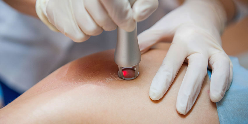 patient receiving cold laser therapy in Wilmington