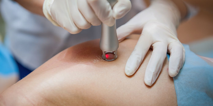 patient getting cold laser treatment in Wilmington